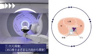 【中部国際医療センター】陽子線がん治療センター 紹介動画