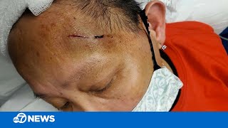 EXCLUSIVE: SF Walgreens employee scared to work after she was attacked by suspected shoplifter