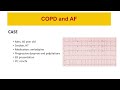 atrial fibrillation and copd shared pathways and implications for cardiovascular health