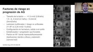 Nuevas alternativas de tratamiento en degeneración macular seca