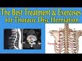 The Best Natural Treatment and Exercises for Thoracic Disc Herniation - Dr Mandell