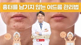 여름철, 흉터 남기지 않는 여드름 관리법