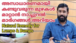 Home Remedy for Unnatural Lumps \u0026 Bumps, ശരീരത്തിലെ അസാധാരണമായ മുഴകൾ മാറാൻ നാച്ചുറൽ റെമഡി