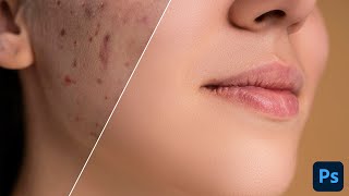 How to RETOUCH SKIN like a PRO in Photoshop - Easy Tips !!