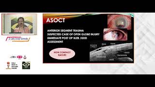 KSOS 2024 IC79 T ASOCT or UBM The Which and Why   Dr JAINY JOSEPH EMMATTY