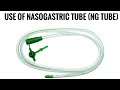 Use of nasogastric tube (NG tube) by Kshitij Foundation Chhindwara