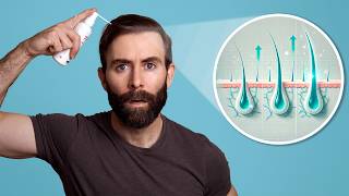 Don't Use Minoxidil Without Knowing This