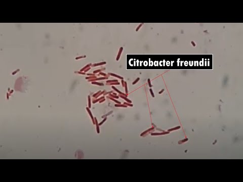 Is Citrobacter Freundii Gram positive or negative?