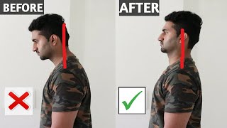 Fix Forward Head Posture ! INSTANT NECK PAIN RELIEF ! HINDI