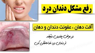 Herbal treatment for toothache/درمان دندان درد،آفت دهان و لثه/درمان خانگی سریع برای دندان درد