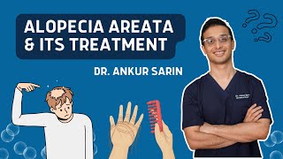 Alopecia Areata Treatment | Injections natural remedies treatment in Hindi | Dr.