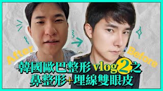 韓國歐巴整形vlog2之 鼻整形+埋線雙眼皮 ｜韓國必嫵整形醫院View Plastic Surgery