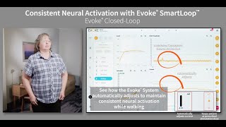 Consistent Neural Activation with Evoke® SmartLoop™ Technology