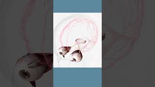 What is amblyopia?