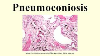 Pneumoconiosis