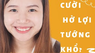 Cười hở lợi là tường khổ đúng với đàn ông còn phụ nữ thì ...?