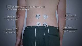 Lumbar and Sacral Placement for Pain and Back Issues Example