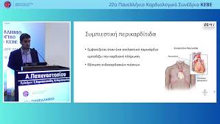 Α. Παπαναστασίου | Νέος ασθενής με κολπική μαρμαρυγή. Μία αναπάντεχη έκπληξη | Γ.Ν.Θ. «Γ. ΠΑΠΑΓΕ...