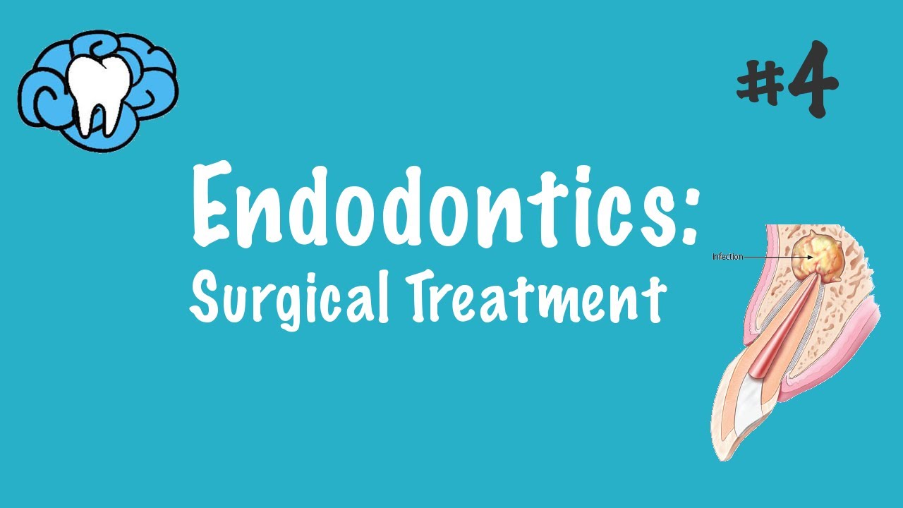 Endodontics | Surgical Treatment | INBDE, ADAT - YouTube