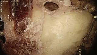 Seocon Bone Dissection Dr Satish Jain SEOCON 2024