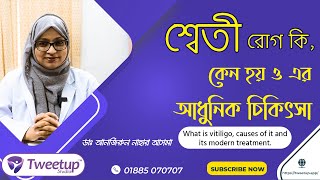 শ্বেতী রোগ কি, কেন হয় ও এর আধুনিক চিকিৎসা- What is vitiligo, causes and its modern treatment. [4K]