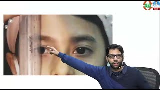 Ptosis IN TOTO: Ophthalmology by Dr Sourabh Sharma