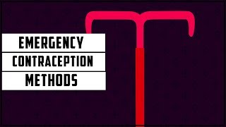 Emergency Contraception Methods