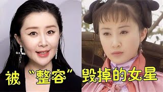 被整容毁掉的女星，孙菲菲脸僵认不出，舒畅真成了“天山童姥”！