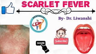 Scarlet Fever in 5 Minutes | Oral Pathology