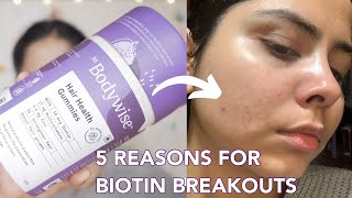 I Tried Biotin for the First Time \u0026 It Went Wrong | 5 Reasons why Biotin Can Cause Acne \u0026 Rashes