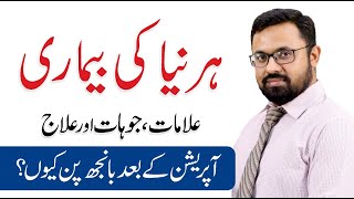 Hernia Surgery - Symptoms, Causes \u0026 Treatment In Urdu | Dr. Idress Gondal