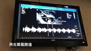 【懷孕日誌】11W6D 頸部透明帶 初唐檢查