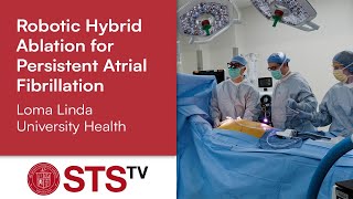 Robotic Hybrid Ablation for Persistent AFib – Loma Linda Department of Cardiothoracic Surgery