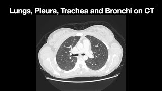 Anatomy of the Lung, Pleura, Trachea and Bronchi on CT