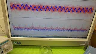 オリジナル超音波プローブの「発振・制御」技術　Ultrasonic system