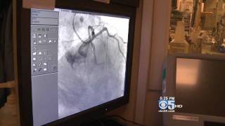 CBS 5 Interviews UCSF Doctors about Heart Attacks and Other Holiday-Related Emergencies
