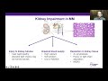 Using REVLIMID as a Successful Treatment for Myeloma Patients with Kidney Involvement