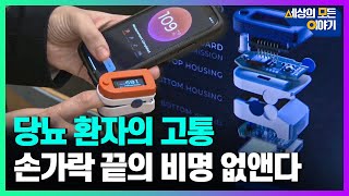 당뇨 환자들은 주목! 고통없이 당뇨를 확인할 수 있는 장치 개발ㅣ세모이 [31회] / YTN2