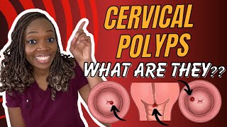 What are cervical polyps and how do you get them?