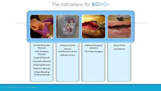 Webinar: Healing Wounds with Collagen: Knowing the Difference Makes All the Difference