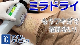 ミラドライ 施術動画 アイシークリニック