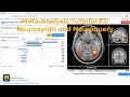 fMRI Meta-Analysis Tutorial #3: Neurosynth & Neuroquery