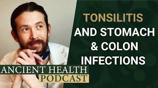 Chronic Tonsillitis and It's Relationship to Hidden Stomach and Colon Infections