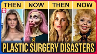 50 Celebrity Plastic Surgery Disasters | You’d Never Recognize Today,
