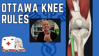 Ottawa knee rules explained - Knee Xray guidelines