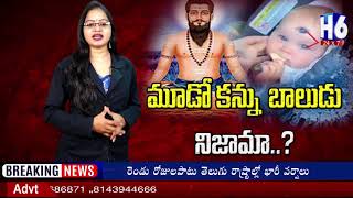 మూడు కళ్ళతో పుట్టిన బేబీ...ఇది నిజమా? | Three eyes baby this is really...??