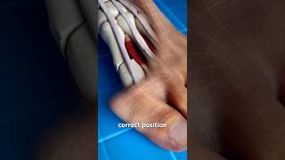 Bunion Correction Explained 🧐 Doctor Reacts
