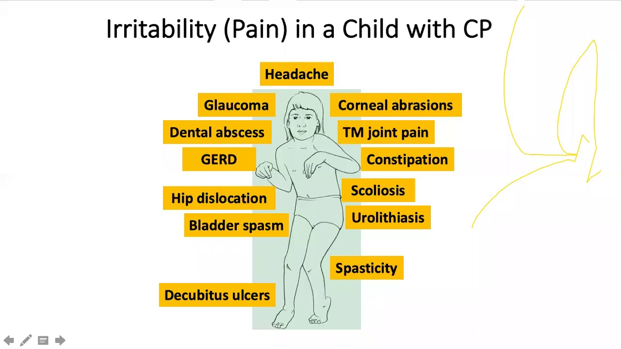 Motor Examination In Children With Cerebral Palsy Explained - YouTube