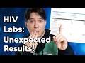 Shocking Result in my HIV Labs!