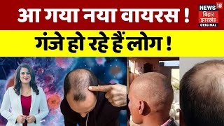 Maharashtra Bald Virus : वायरस की मार, गंजे हो जा रहे लोग ! | Buldhana News | Takla Virus | N18V